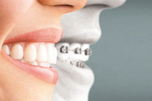 La ortodoncia – Salud Dental con la Dr. Bernarda Alcántara