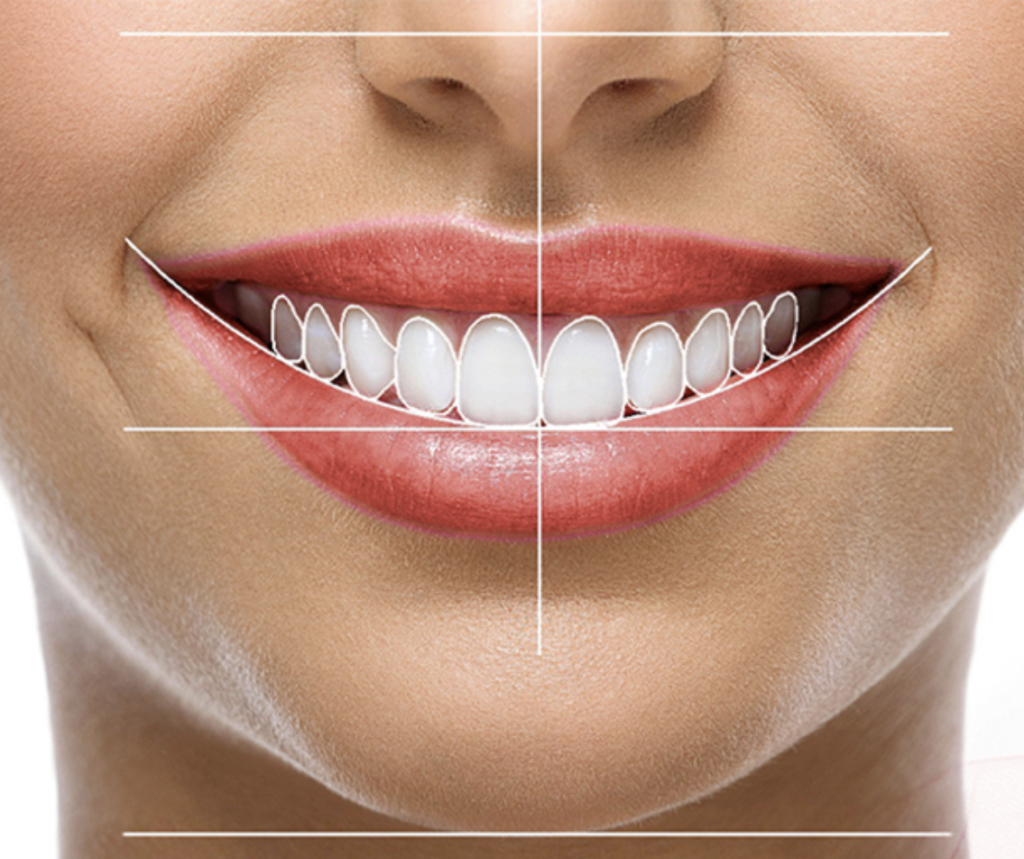 qué es el diseño de sonrisa parte ii salud dental con la dr