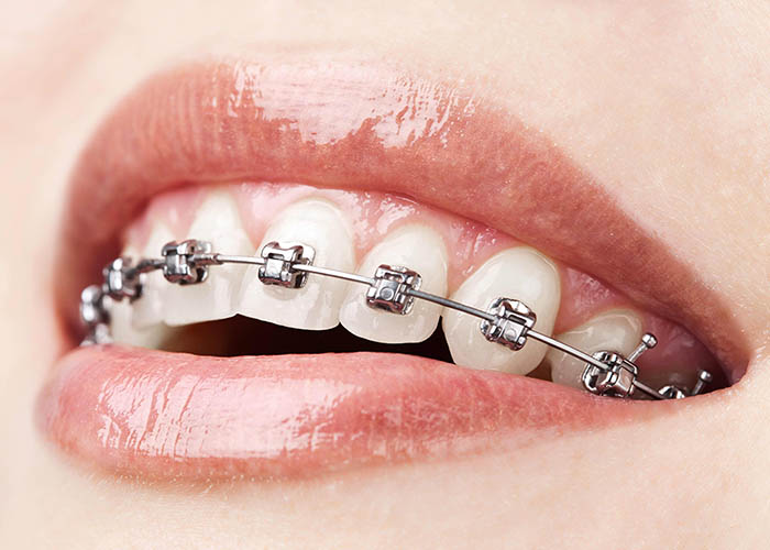 La ortodoncia – Salud dental con la Dr. Bernarda Alcántara