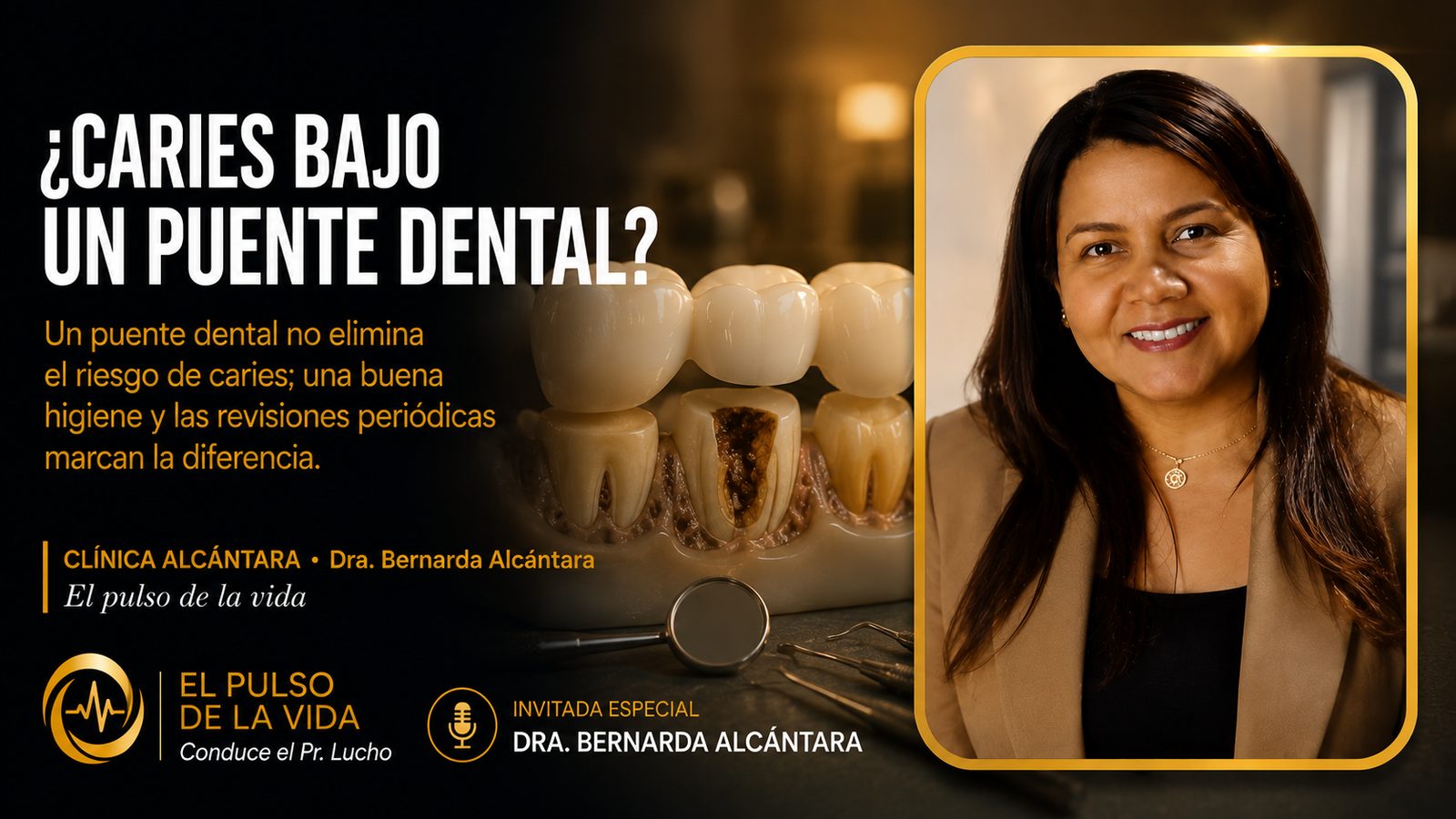 ¿Caries bajo un puente dental? | Dra. Bernarda Alcántara
