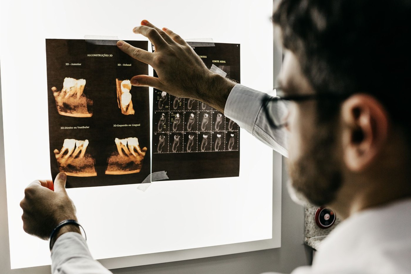 Un odontólogo revisa radiografías dentales en un negatoscopio