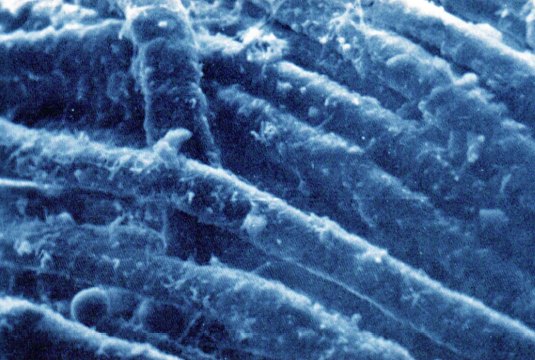 Microscopía electrónica de barrido de las fibras del lienzo con un grano de polen